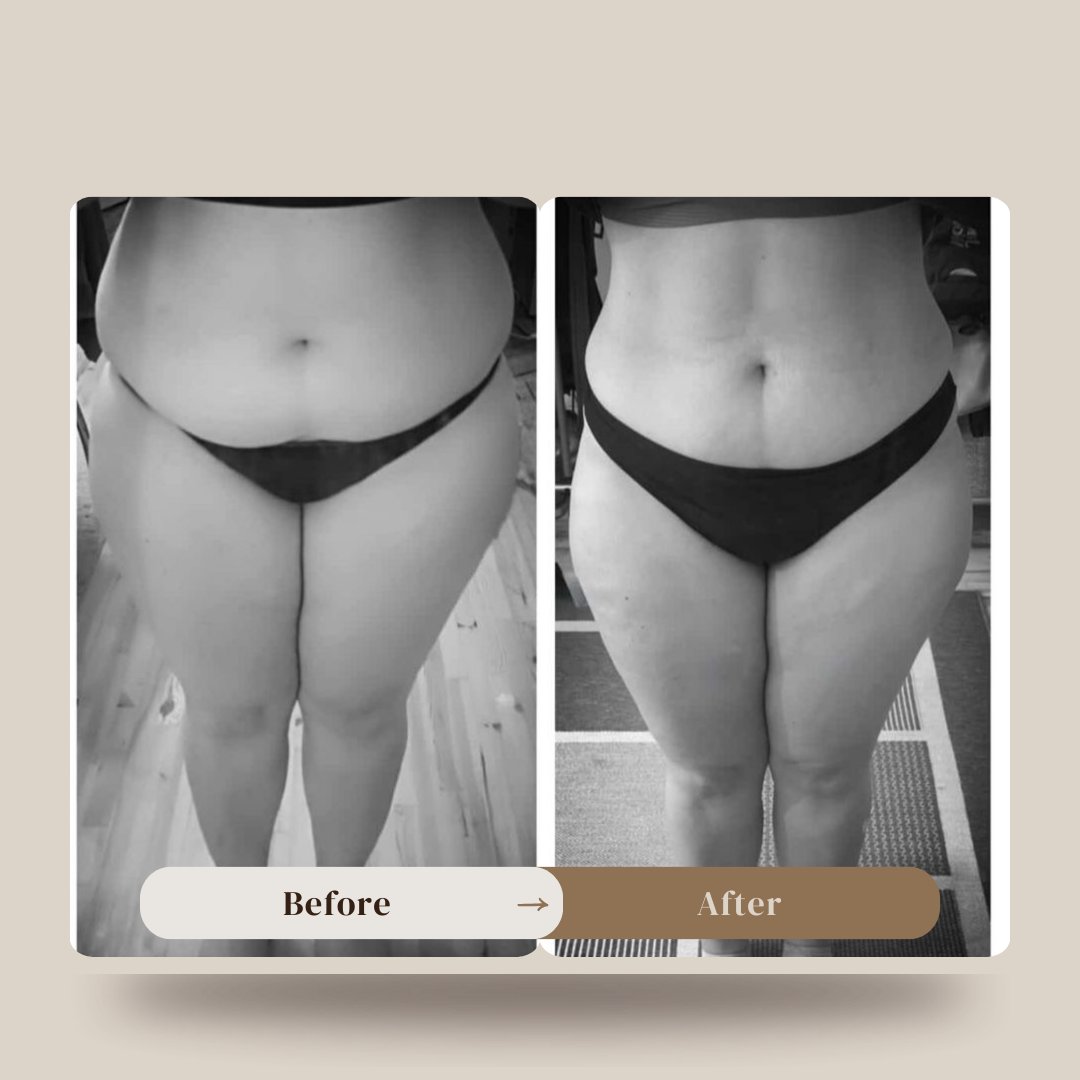 Before and After Transformation 5