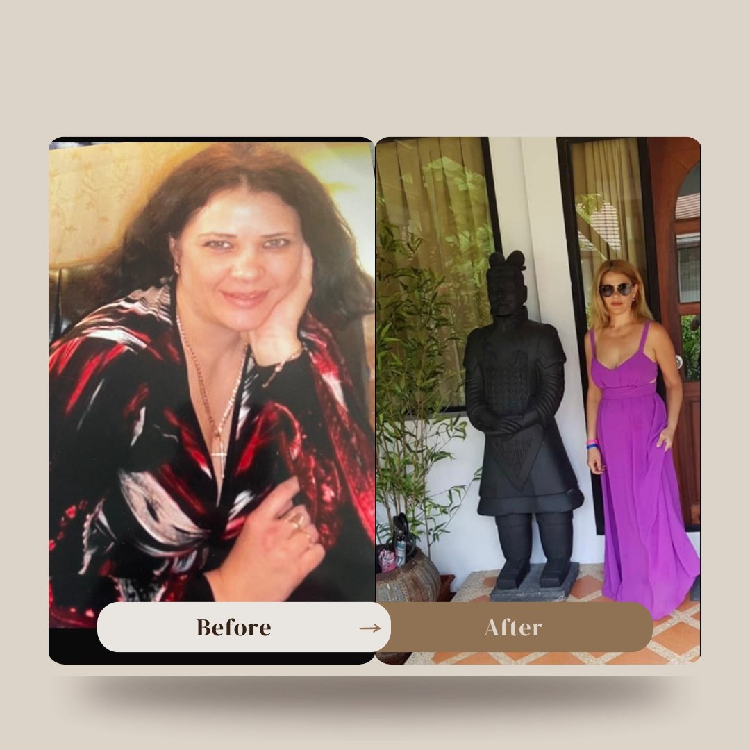 Before and After Transformation 3